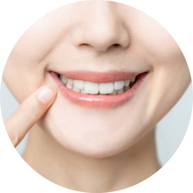 Smiling Woman Pointing At Her Clean Teeth