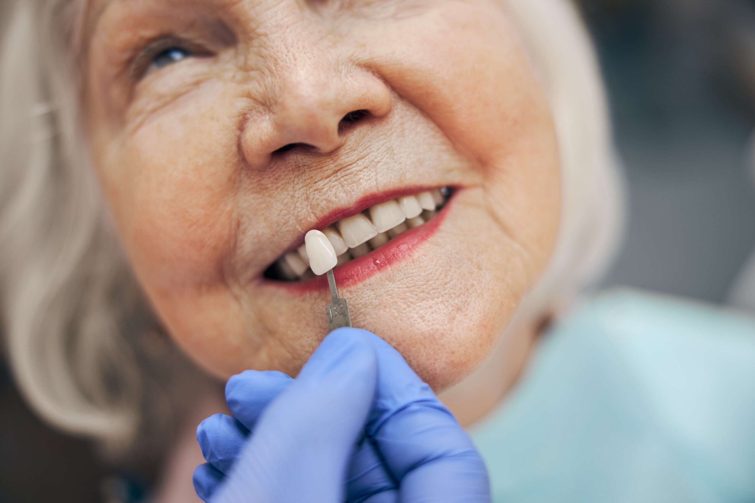 Featured image for “Invisalign in Toronto: Is Clear Aligner Treatment Right for You?”